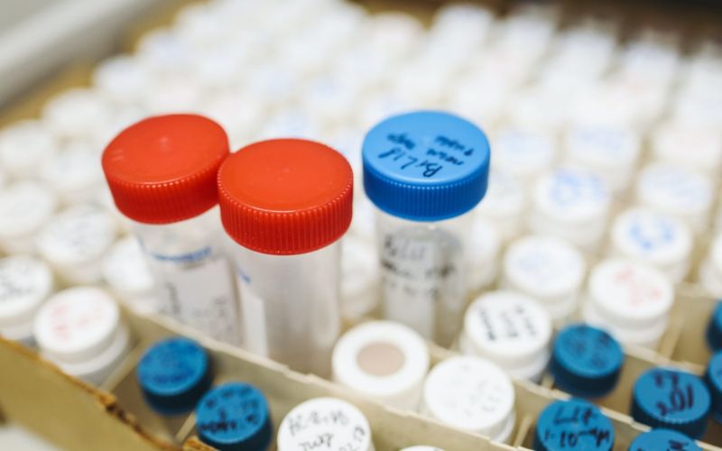 Kiểm tra doping là gì trong bóng đá